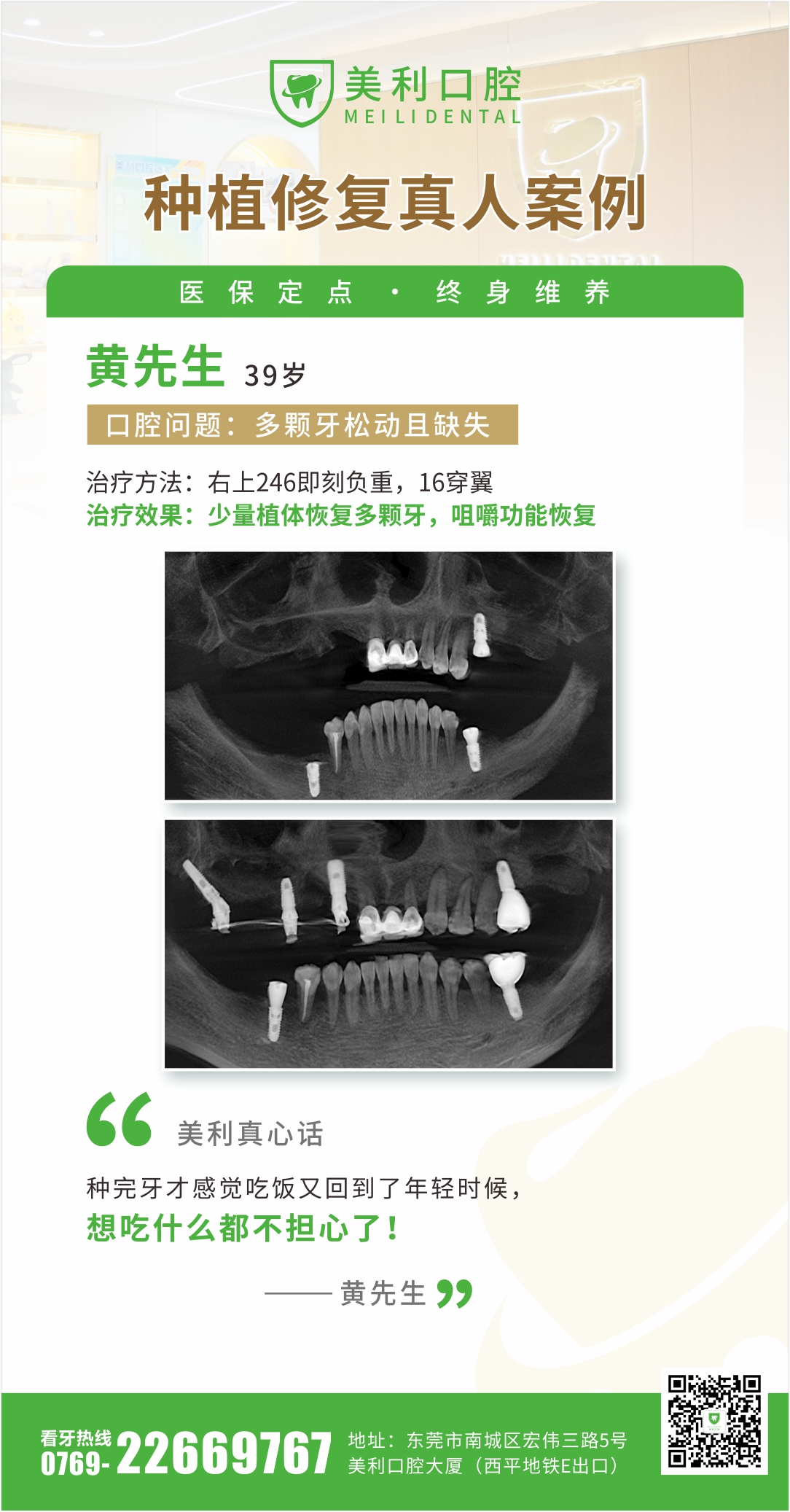 正畸案例