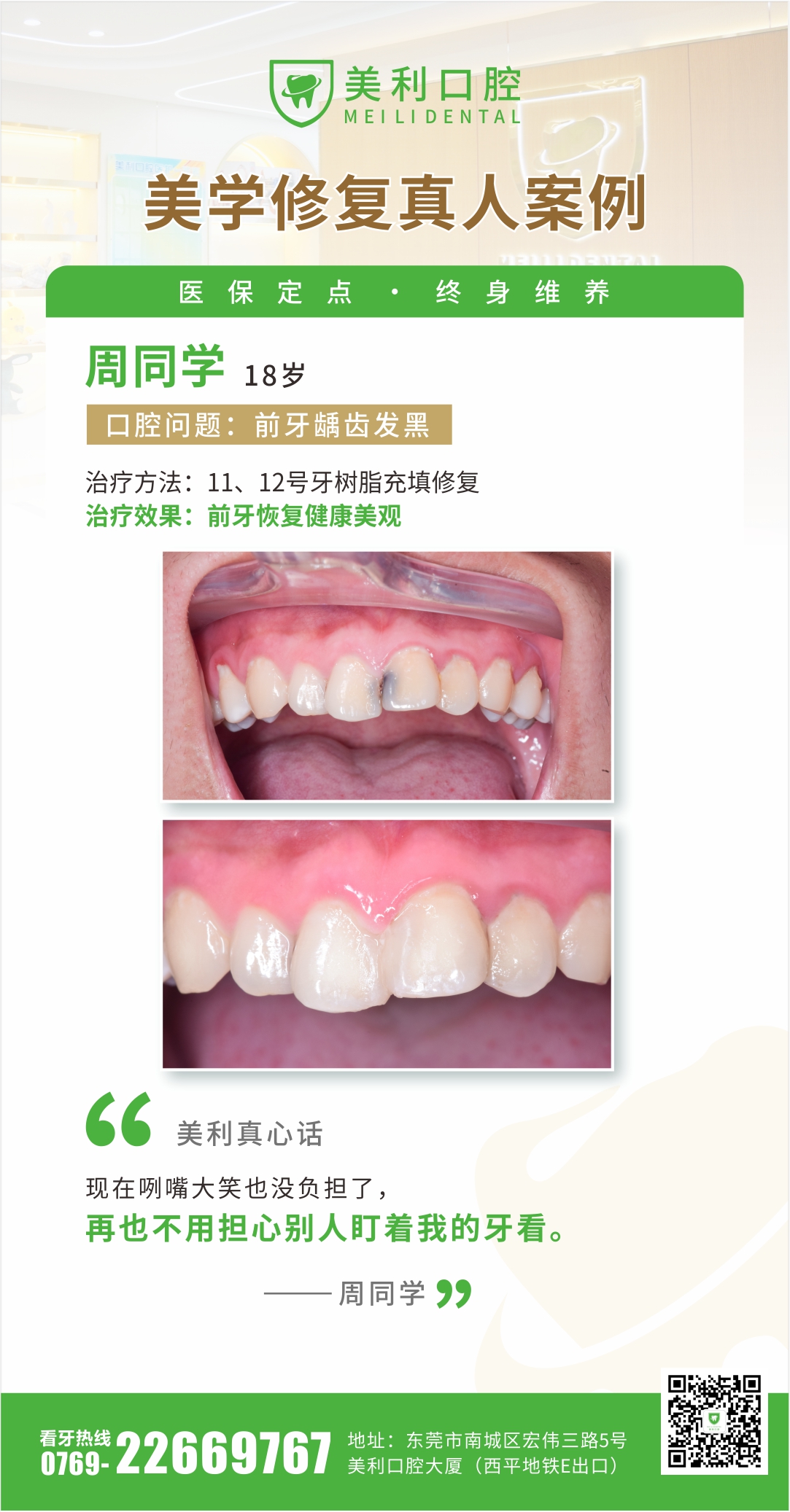 美学修复案例