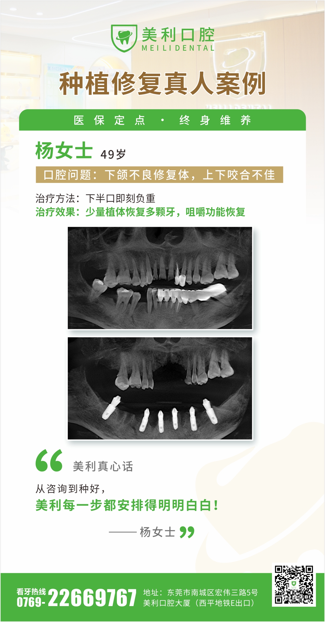 修复案例
