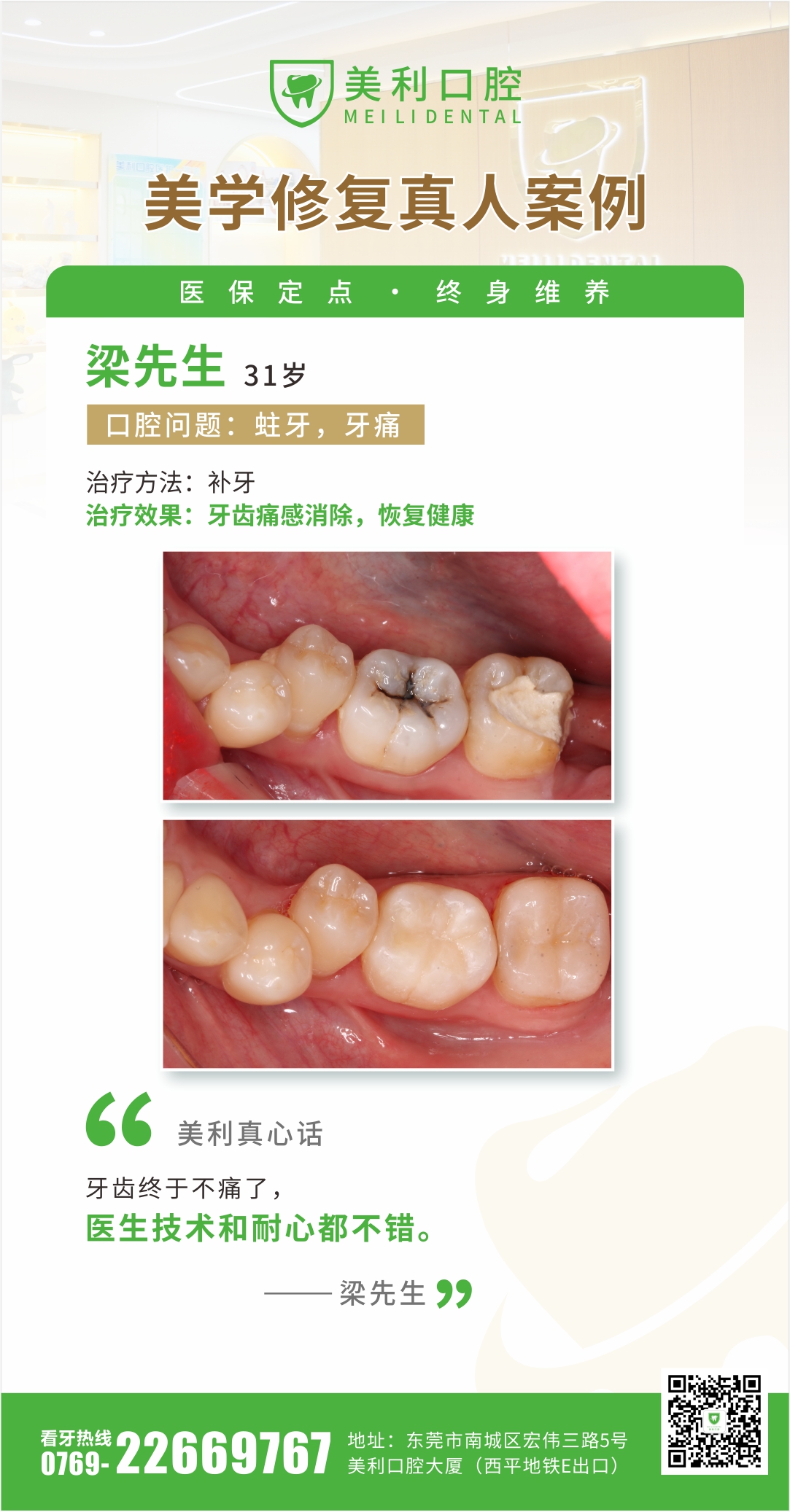 美学修复案例