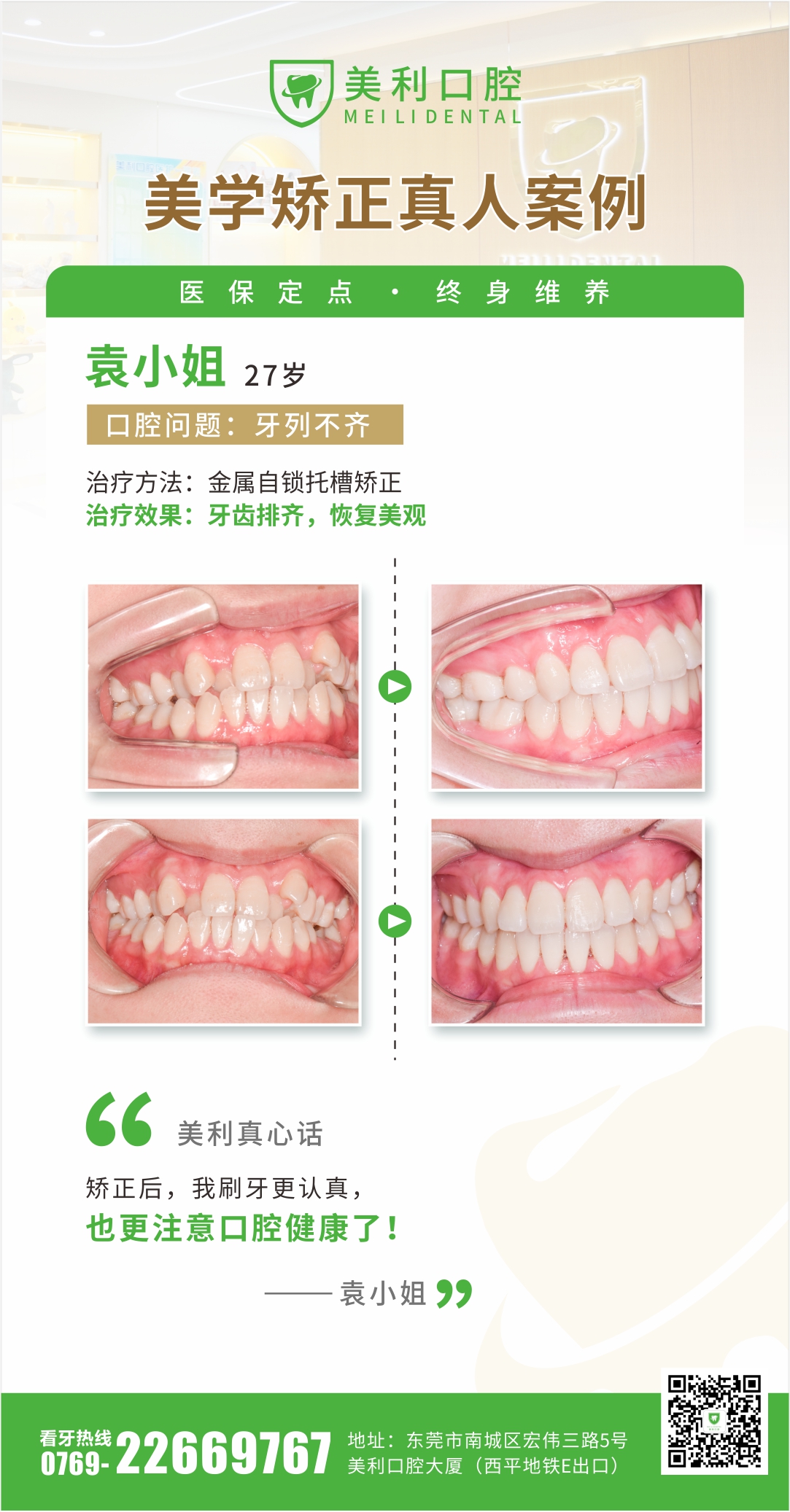美学矫正案例