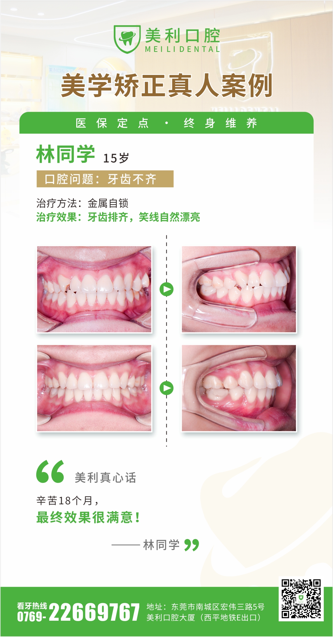 美学矫正案例