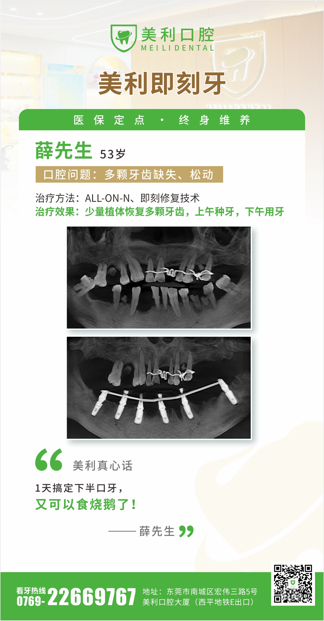 即刻种植案例
