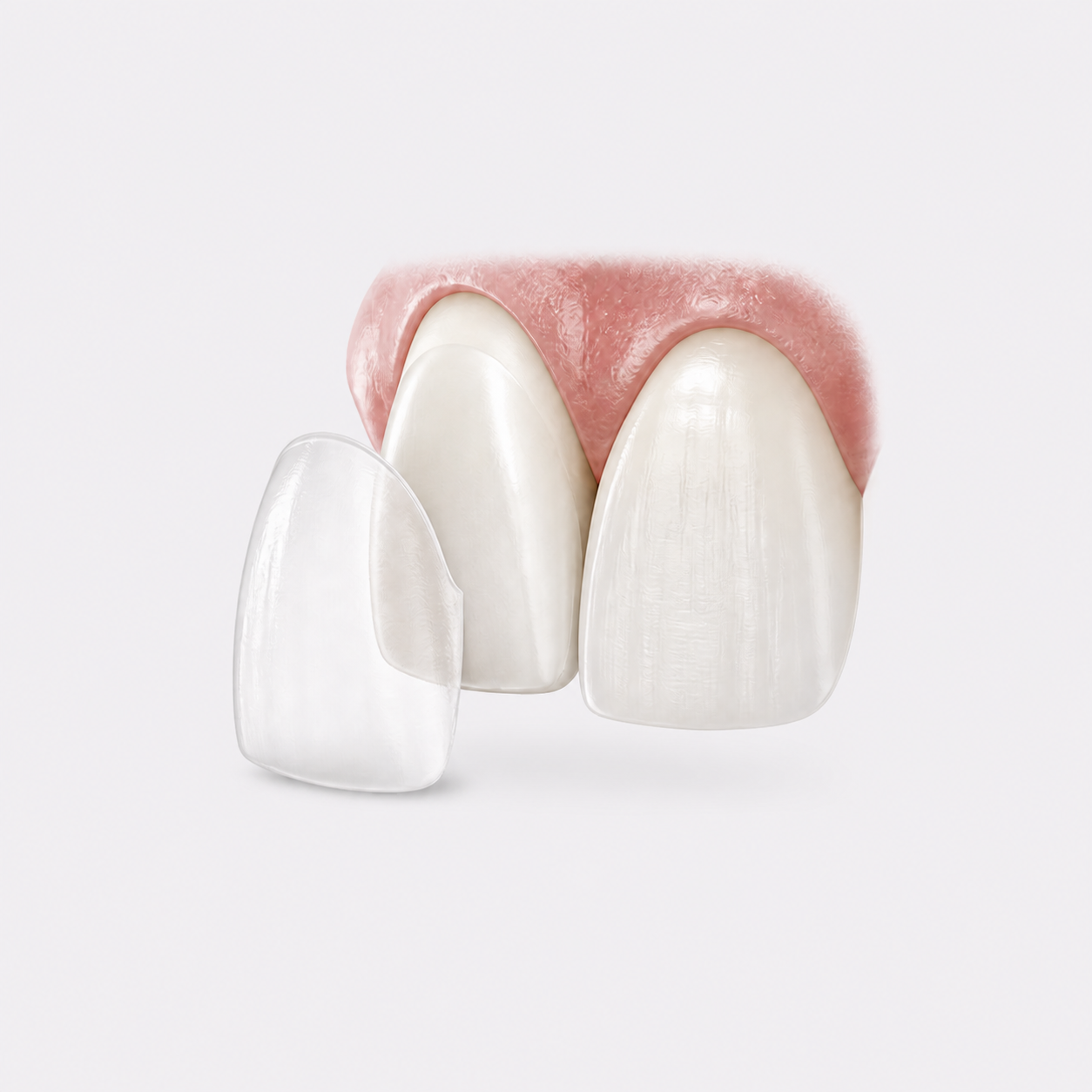 精致美学修复项目示意图